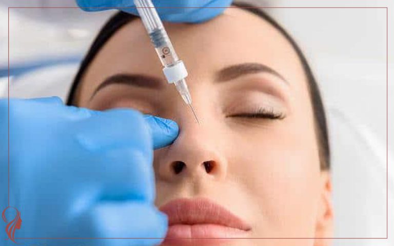 فرم دهی بینی با ژل