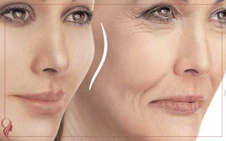 تزریق پروفایلو